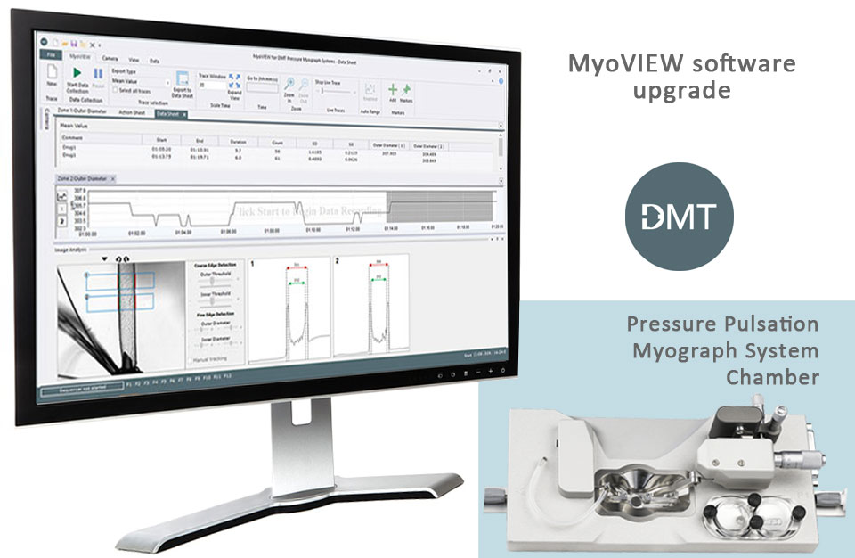 Easy, live diameter tracking for DMT Pressure Myograph Systems