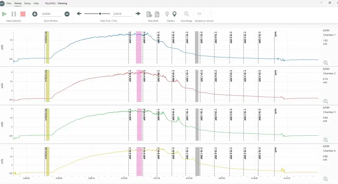 Affordable Efficient Data Acquisition For Dmt Myograph & Organ Baths