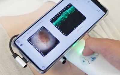 Twice the Vision for Skin Research: Optical + HF Ultrasound