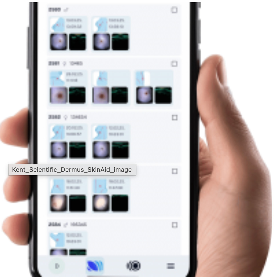 skinaid analysis software